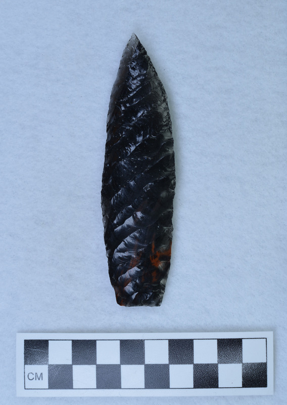 1 side Titmus technique, 1 side Crabtree tech.